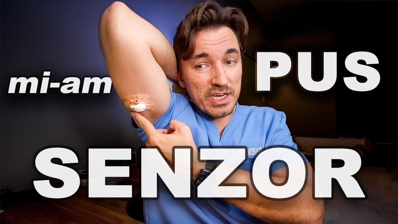 Mi-am pus SENZOR de monitorizare a GLICEMIEI