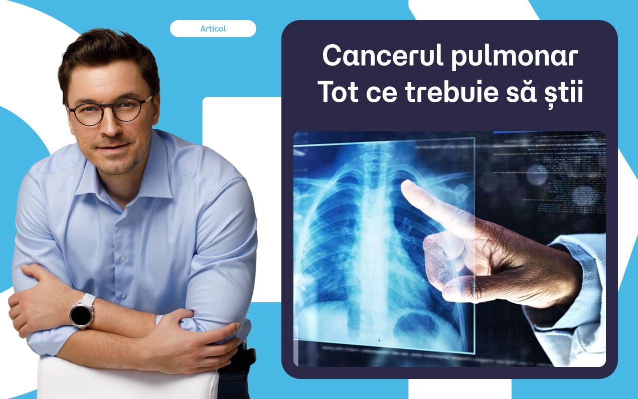 Cancerul pulmonar | Tot ce trebuie să știi