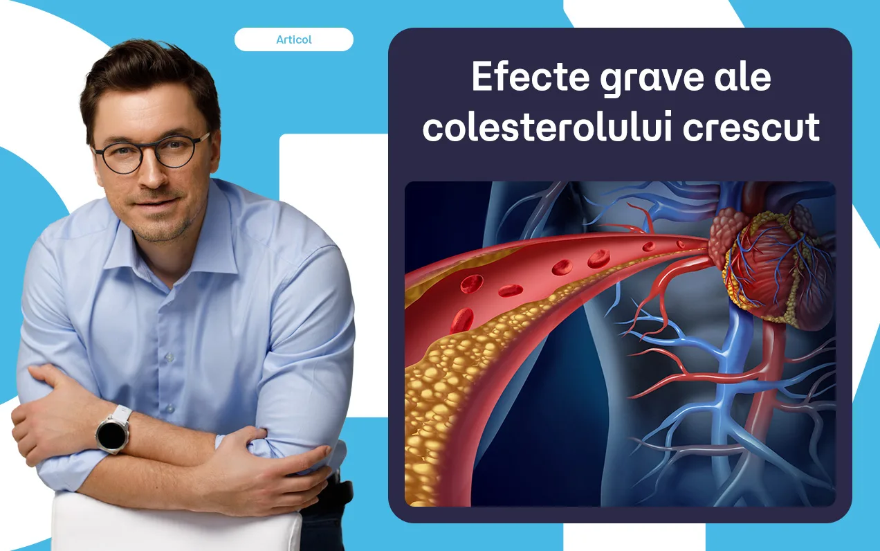 7 efecte grave ale colesterolului crescut